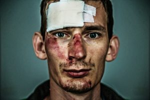 Catastrophic Injury